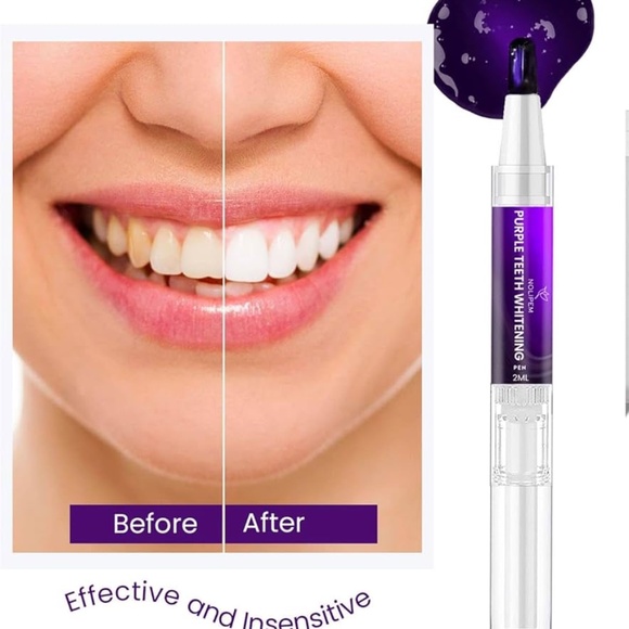 Purple Teeth Whitening Pen (3 Pens) - Picture 2 of 7
